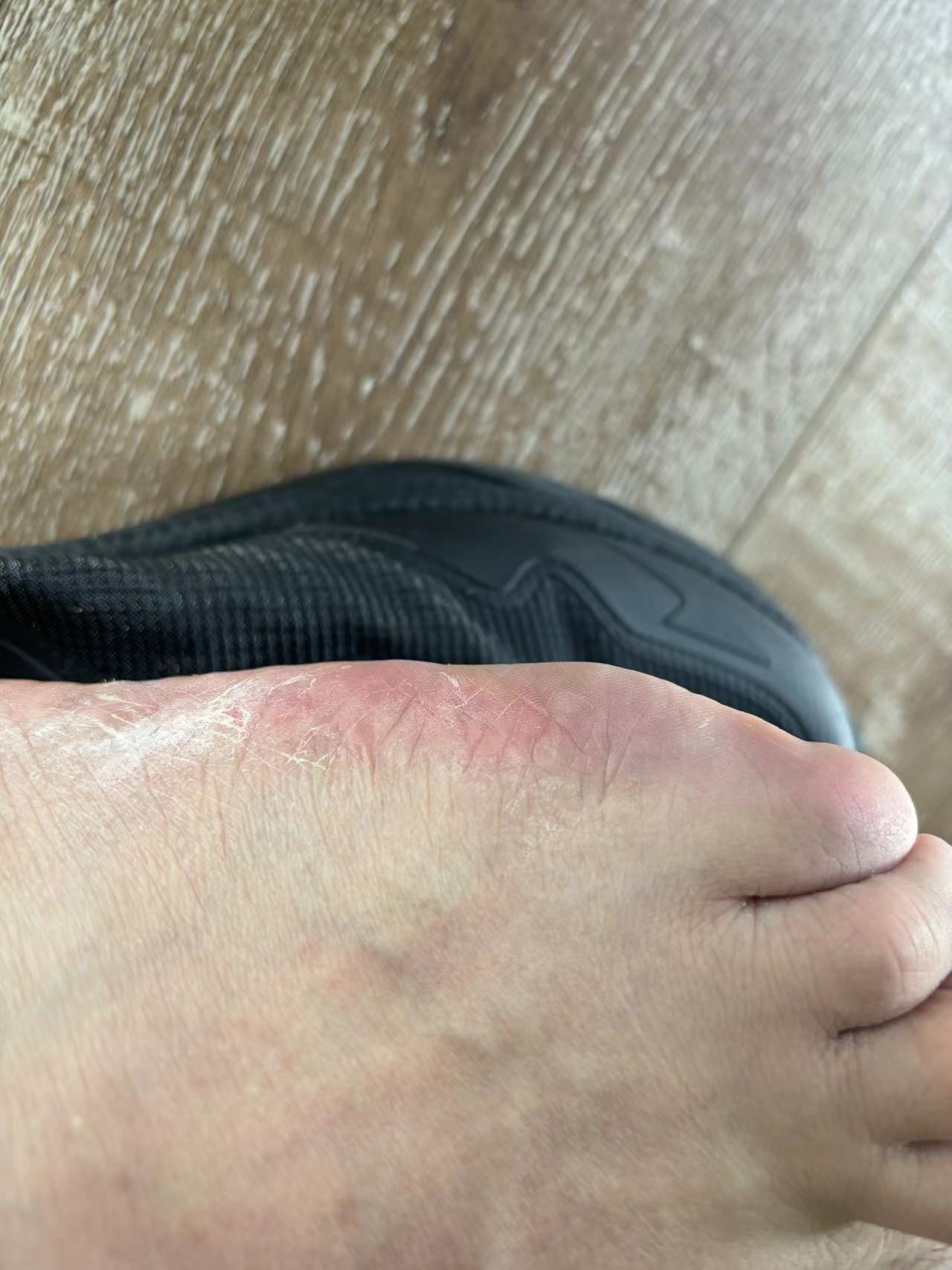 脚外侧会磨到